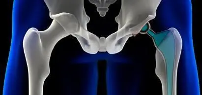 積液4.jpg