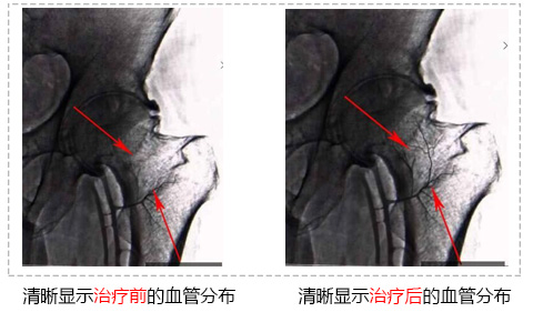 治療前后02.jpg